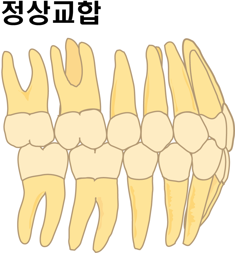 어금니가 1대2로 물리는 정상교합